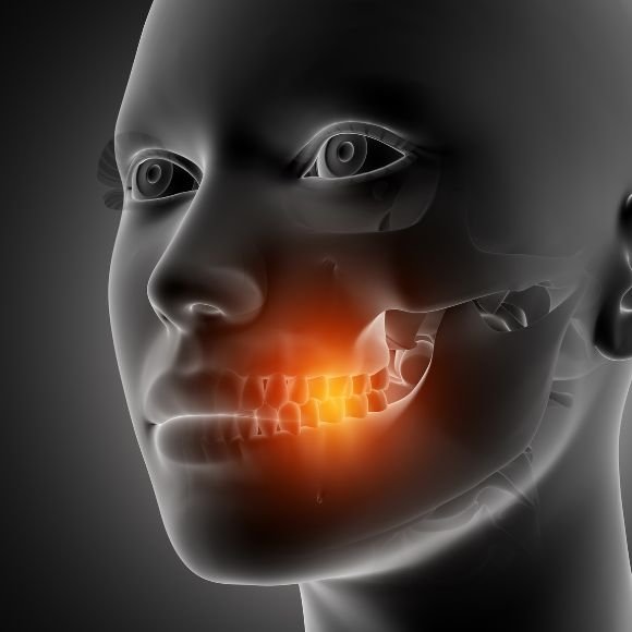 Cirugía Maxilofacial en Bogota - Dr Carlos Castro