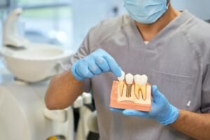 Tipos de implantes dentales